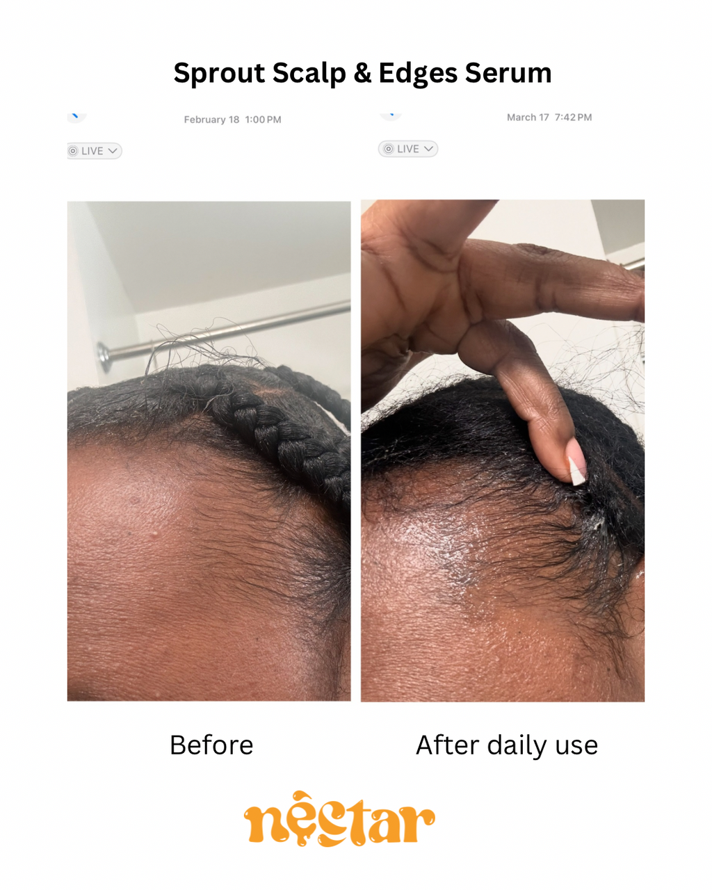Sprout Scalp & Edge Serum
