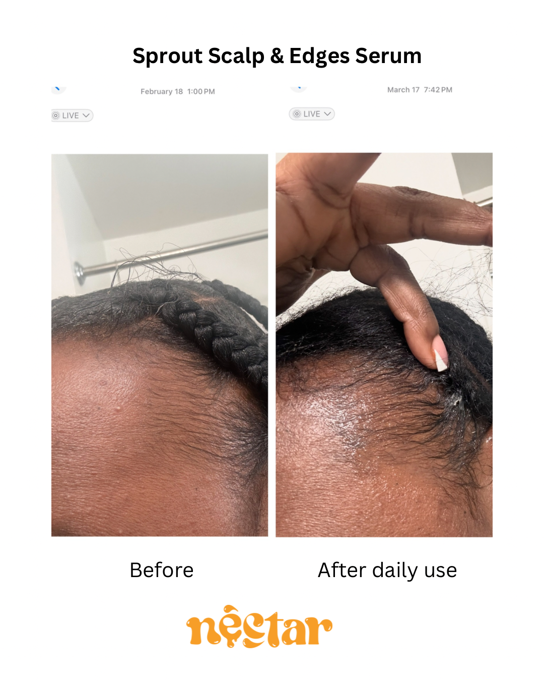 Sprout Scalp & Edge Serum